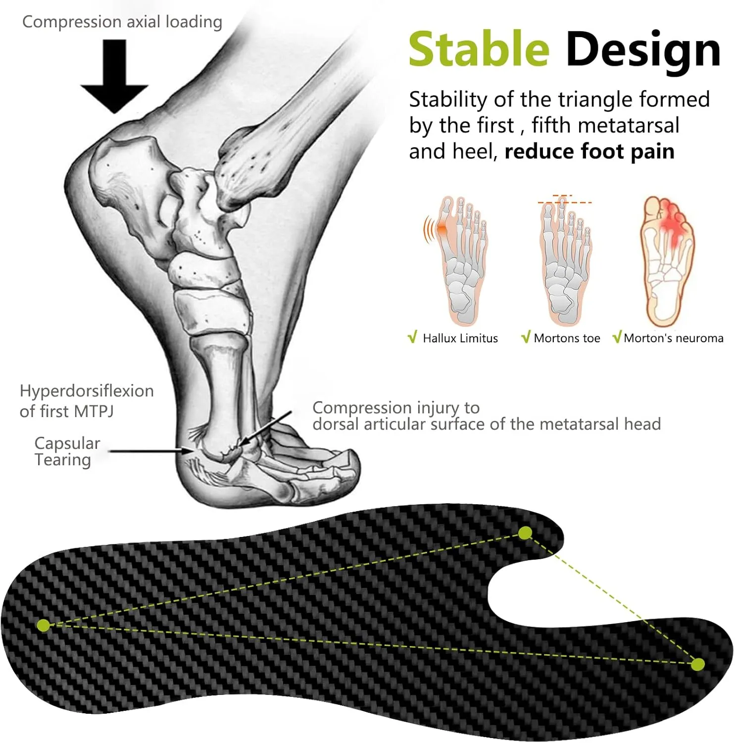 Carbon Fiber Insole (1 PC),Morton's Extension Orthotic, Turf Toe Relief Insole,Foot Fractures, Hallux Rigidus and Limitus, Shoe Inserts for Women Men - Alternative to Post Op Shoe 235mm 1 Piece Black